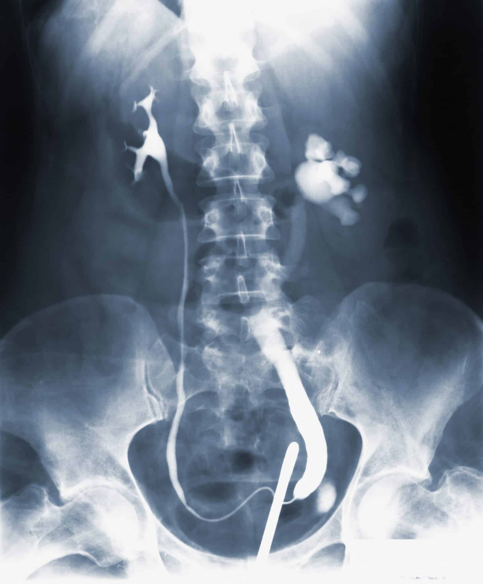Could Your Abdominal Pain Be Affecting Your Heart Rate? - kpfrxyy